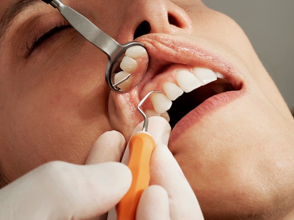 Imagem representativa de planos odontológicos